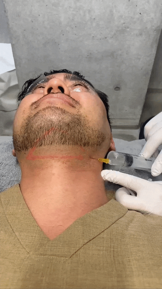 アゴ (1).gif