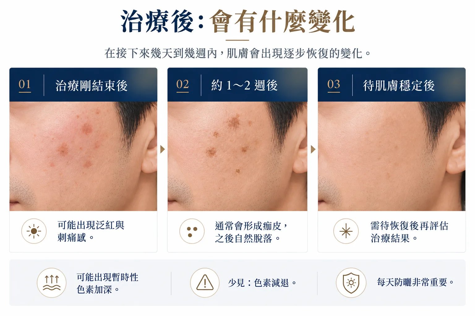治療後:會有什麼變化。在接下來幾天到幾週內,肌膚會出現逐步恢復的變化。01 治療剛結束後:可能出現泛紅與刺痛感。02 約1〜2週後:通常會形成痂皮,之後自然脫落。03 待肌膚穩定後:需待恢復後再評估治療結果。可能出現暫時性色素加深。少見:色素減退。每天防曬非常重要。