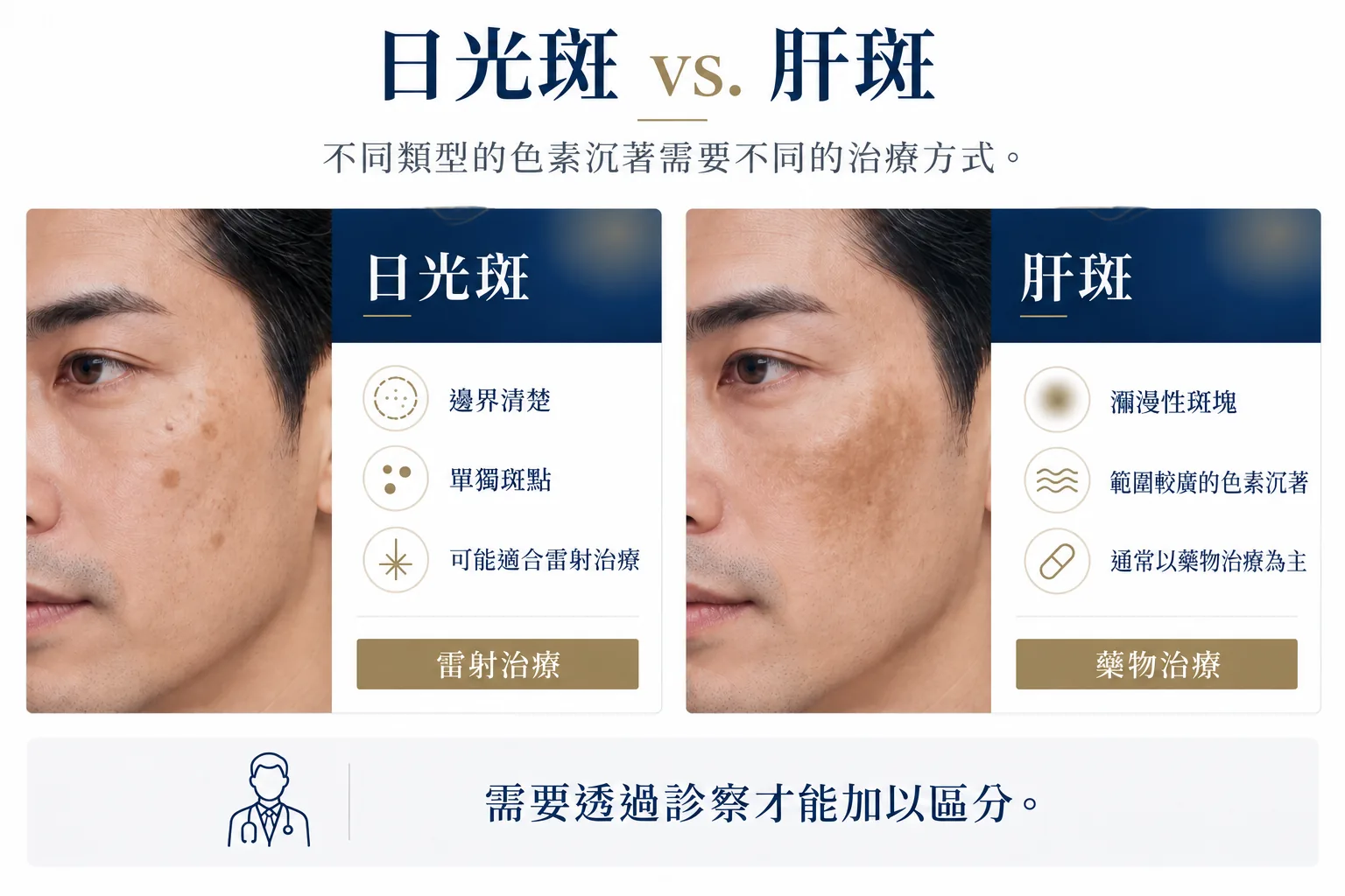 日光斑 vs. 肝斑:不同類型的色素沉著需要不同的治療方式。日光斑:邊界清楚、單獨斑點、可能適合雷射治療;雷射治療。肝斑:瀰漫性斑塊、範圍較廣的色素沉著、通常以藥物治療為主;藥物治療。需要透過診察才能加以區分。