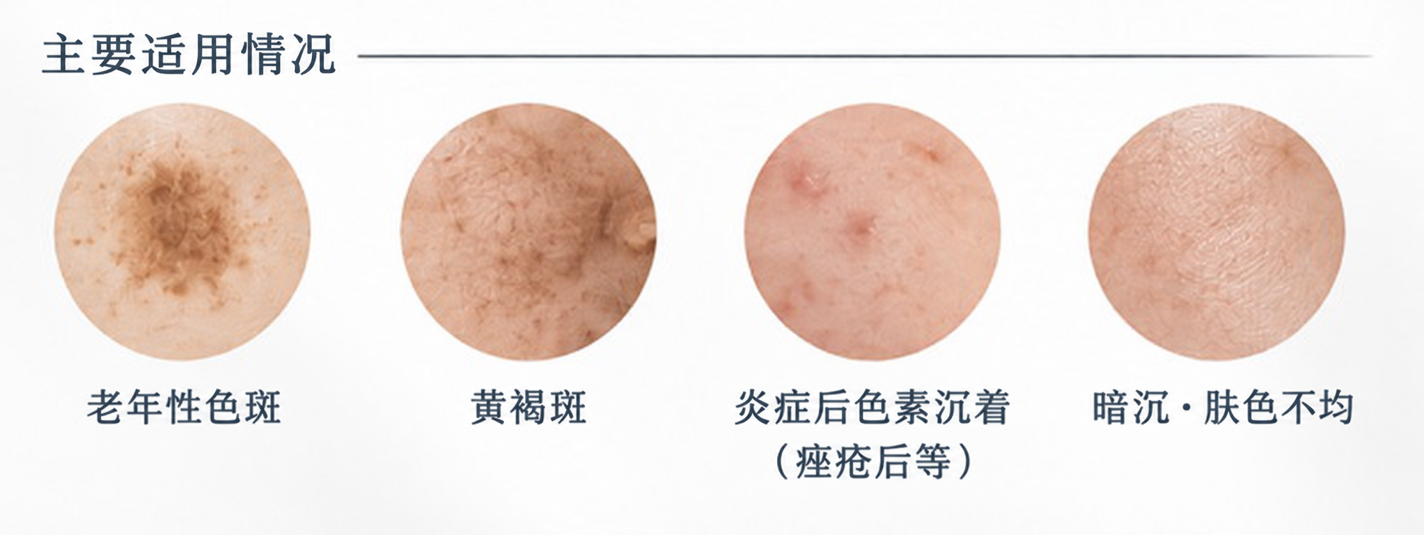 氢醌的主要适用情况