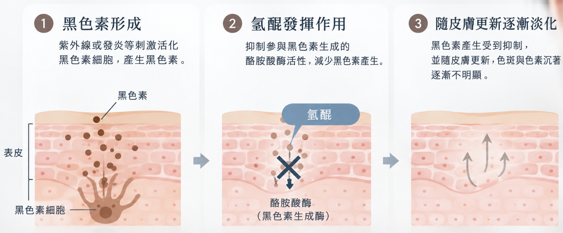 氫醌作用的三階段:紫外線或發炎刺激黑色素細胞,氫醌妨礙酪胺酸酶作用,色素隨皮膚更新逐漸不明顯。