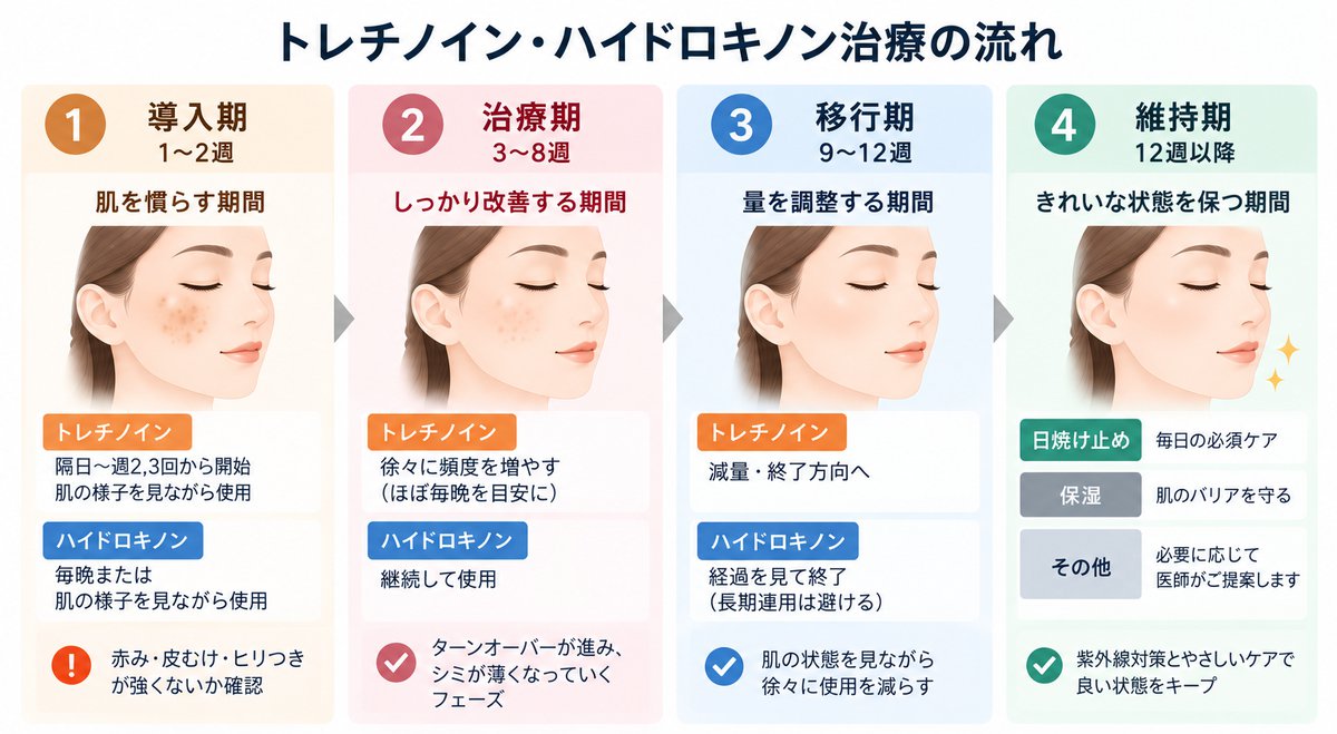 トレチノイン・ハイドロキノン治療の流れ。導入期1〜2週、治療期3〜8週、移行期9〜12週、維持期12週以降の4段階と、各期の使い方を示した図